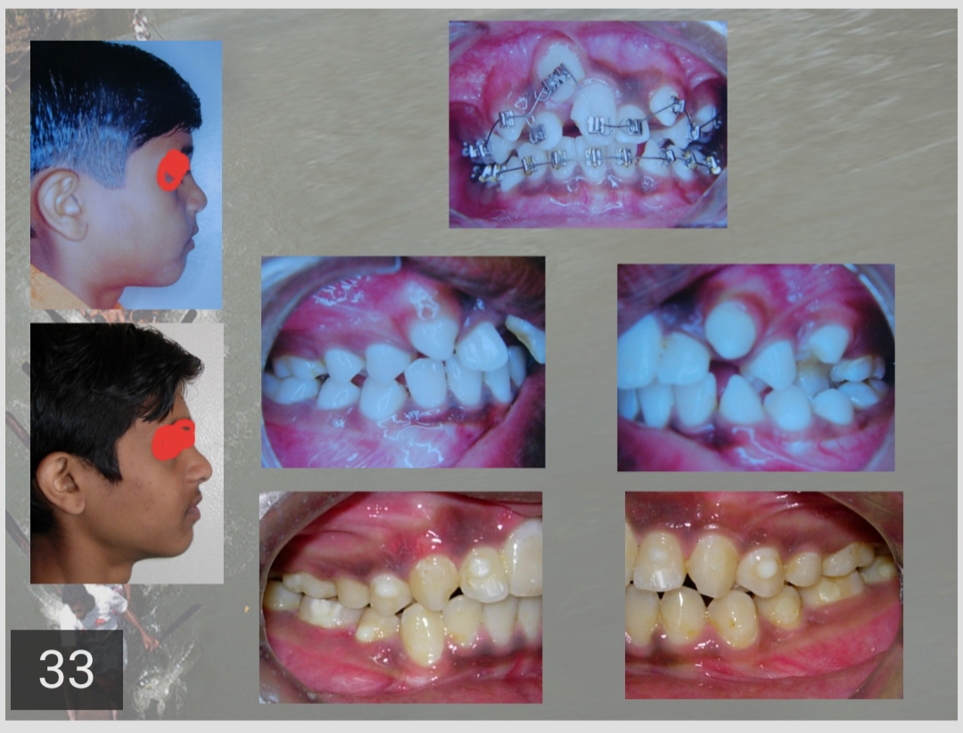 Dentist in ahmednagar